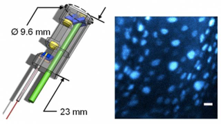 Super-Precise Laser Scalpel Minimizes Collateral Damage